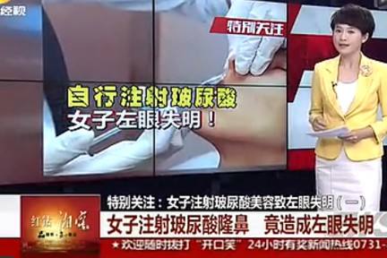 注射玻尿酸的危害图片,注射玻尿酸有害吗