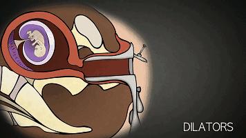 人流手术过程，年轻的女性们，你们真的伤不起！