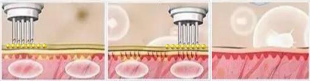 可以置换皮肤内铅汞重金属的五星级修护面霜，时光还幼重返10年前