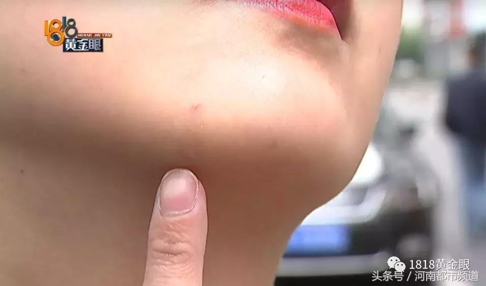 为什么我做溶脂瘦脸都没效果,溶脂瘦脸4天了没有效果