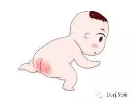 解决宝宝红屁股最快办法,如何应对宝宝红屁股