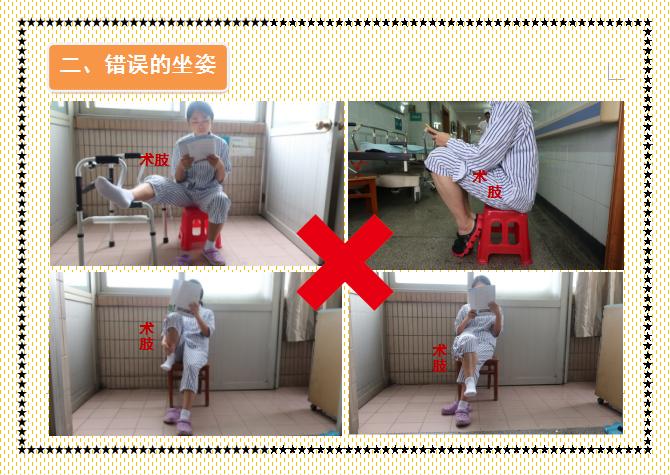 人工股骨头置换术术后教学查房,人工髋关节置换术后护理注意事项