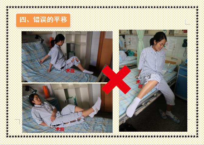 人工股骨头置换术术后教学查房,人工髋关节置换术后护理注意事项