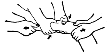 中医骨折治疗原则,中医骨伤整复术