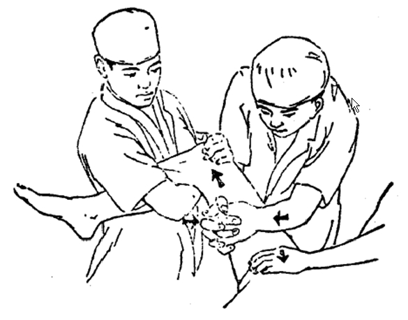 中医骨折治疗原则,中医骨伤整复术