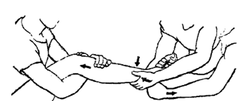 中医骨折治疗原则,中医骨伤整复术