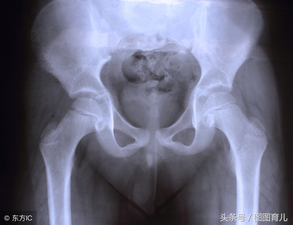 怀孕3个月胯疼怎么回事,怀孕七个月为什么感觉胯部疼