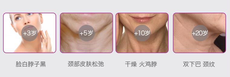 淡化颈纹颈霜排行榜前十名,黑天鹅颈美颈霜