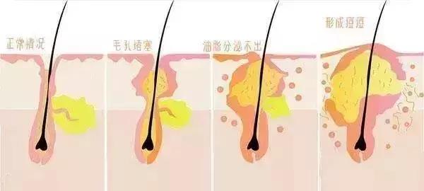 如何选洗澡时用的沐浴刷,怎样洗澡搓背