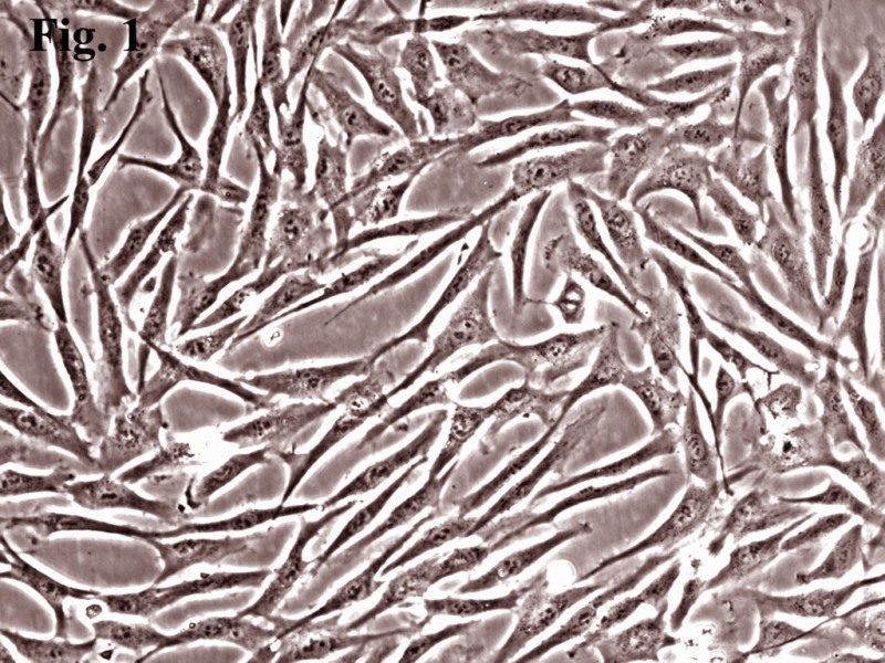 脐带血干细胞治疗内膜有效吗,脐带间充质干细胞能否应用临床