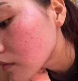 有了这瓶“液体黄金“,今年秋冬注定与干燥、长痘无缘了!