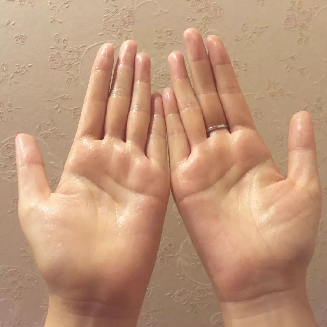 有了全世界3秒卖一瓶的“液体黄金“，干燥、长痘就与你无缘了！