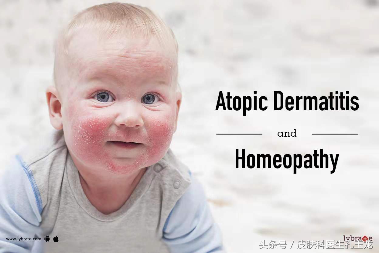 婴儿湿疹导致皮肤干燥怎么治疗,宝宝湿疹皮炎是什么原因引起的