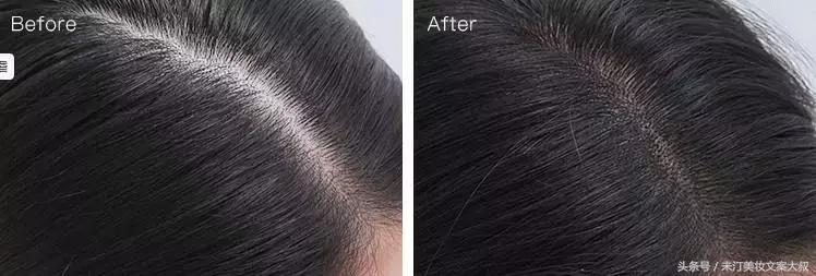 浣犺繕鍦ㄤ负浜嗚劚鍙戠儲鎭煎悧,浣犺繕鍦ㄤ负浣犺劚鍙戠儲鎭艰嚜鍗戝悧