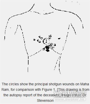 轮回胎记真的有效吗,胎记和轮回