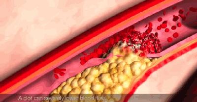 顺产好还是剖宫产好应该怎么选,生孩子到底顺产还是剖腹疼