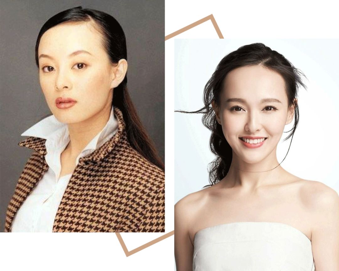 轻微m型脱发如何选择发型,头发脱发断发怎么拯救发量