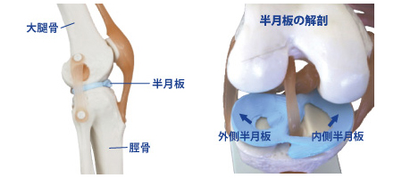 这个病,喜欢运动的人要注意了!医生:不同的损伤治疗方式不同!