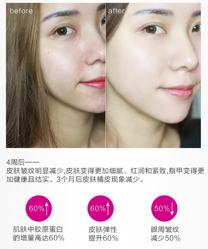 德国胶原蛋白肽原液口服液,德国水解胶原蛋白小分子口服液