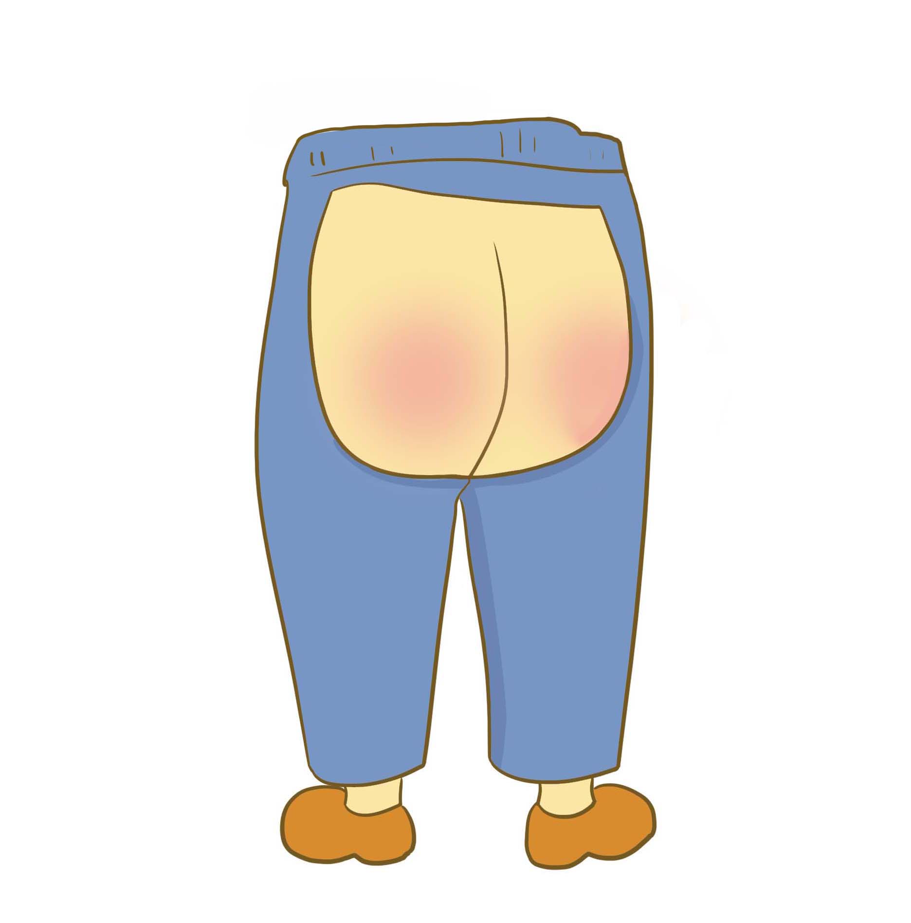 宝宝屁屁一直红是尿片问题吗,宝宝屁屁总是红红的