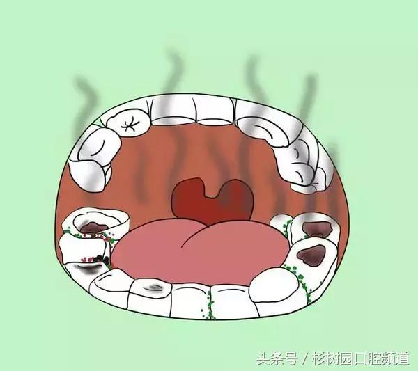 我口臭特严重应该怎么治,口臭到底是我的错吗