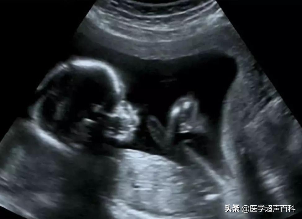 准妈妈b超注意事项,准妈妈们应该做什么检查