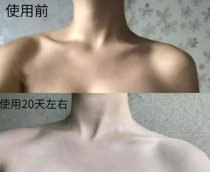 张韶涵如何抗糖,张韶涵抗老秘密