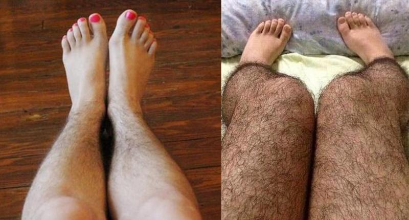 多囊卵巢综合征的四种症状,多囊卵巢综合征的10种表现