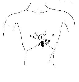 你的胎记在哪个位置看出你的含义,你的胎记在哪里找