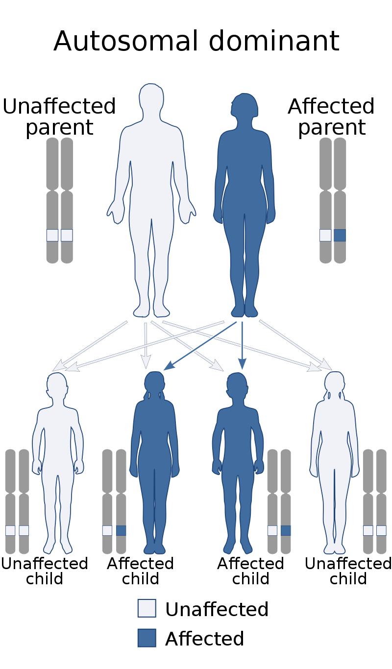 没有指纹的人的命运,天生无指纹的人多吗