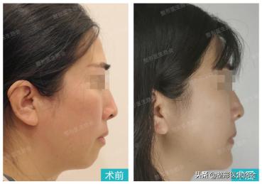 好看的下巴有哪些,好看的下巴