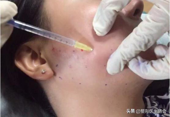 黄晓明颧骨高吗,颧骨高一仰头都凸出来了