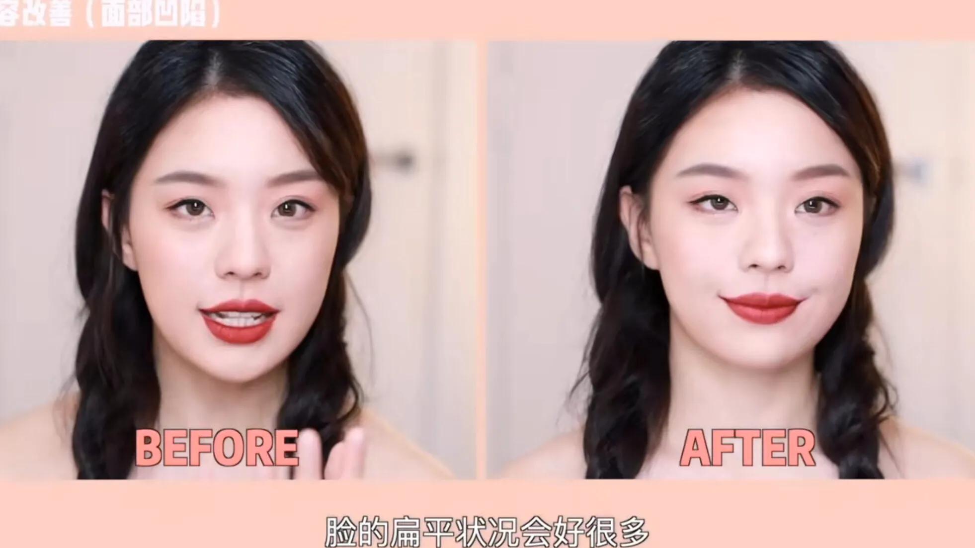 侧颜凸嘴怎么修,让侧脸变好看的方法