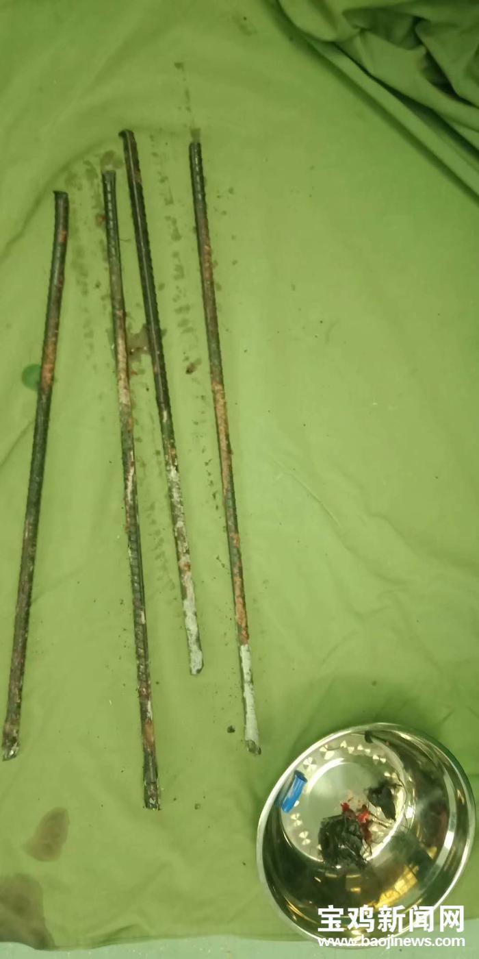 多学科协作救治钢筋贯通伤患者,钢筋刺穿小腿消防医护接力救援