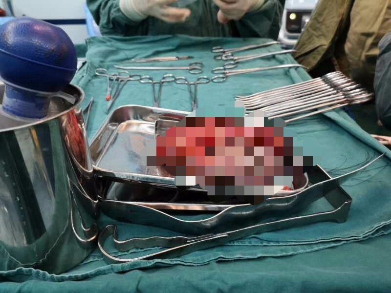 沈阳肝胆胰外科专家,沈阳医大一院肝胆胰专家名单