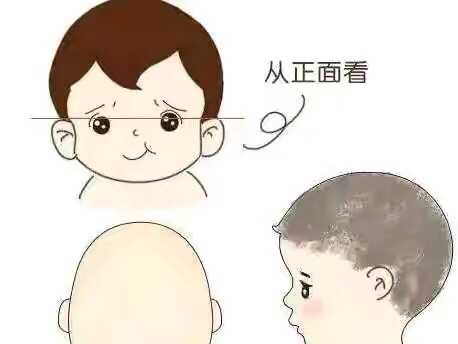 2个月宝宝睡觉头型歪了怎么办,2个月的宝宝头睡偏了怎么办