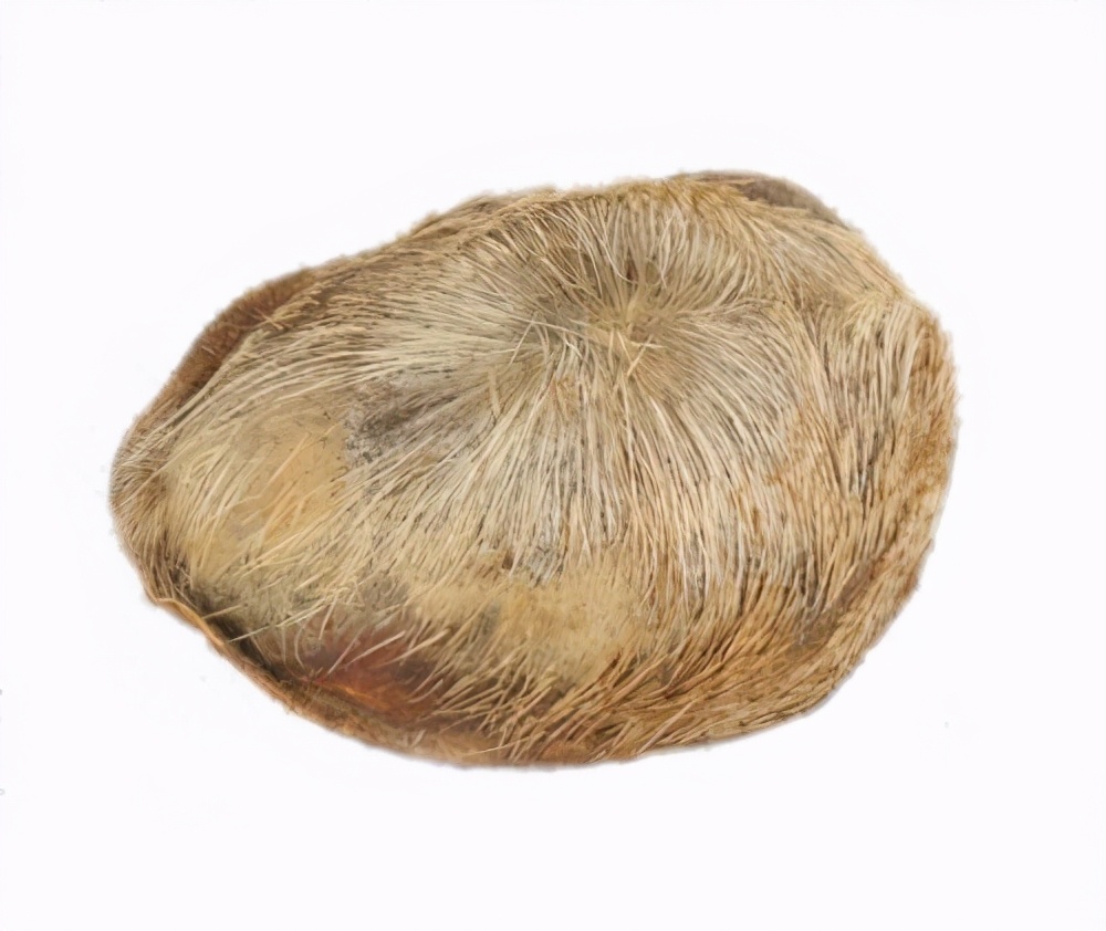 络脉瘀阻怎么治疗,疏通络脉的中成药