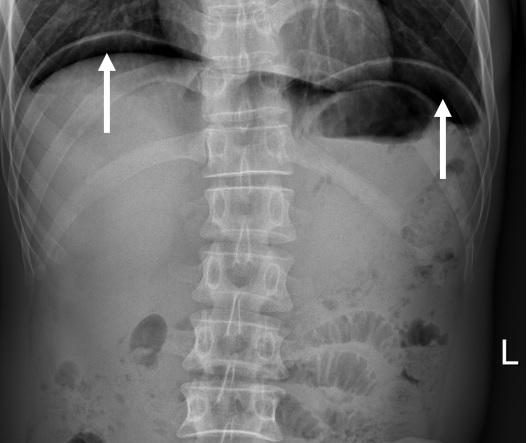 腹痛急剧怎么办？当然是快速准确诊断病因最重要，否则没法治疗