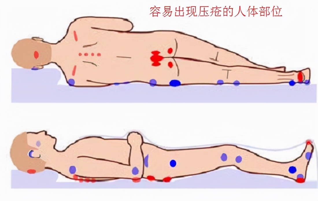 如何使用和护理轮椅,使用轮椅的注意事项有哪些