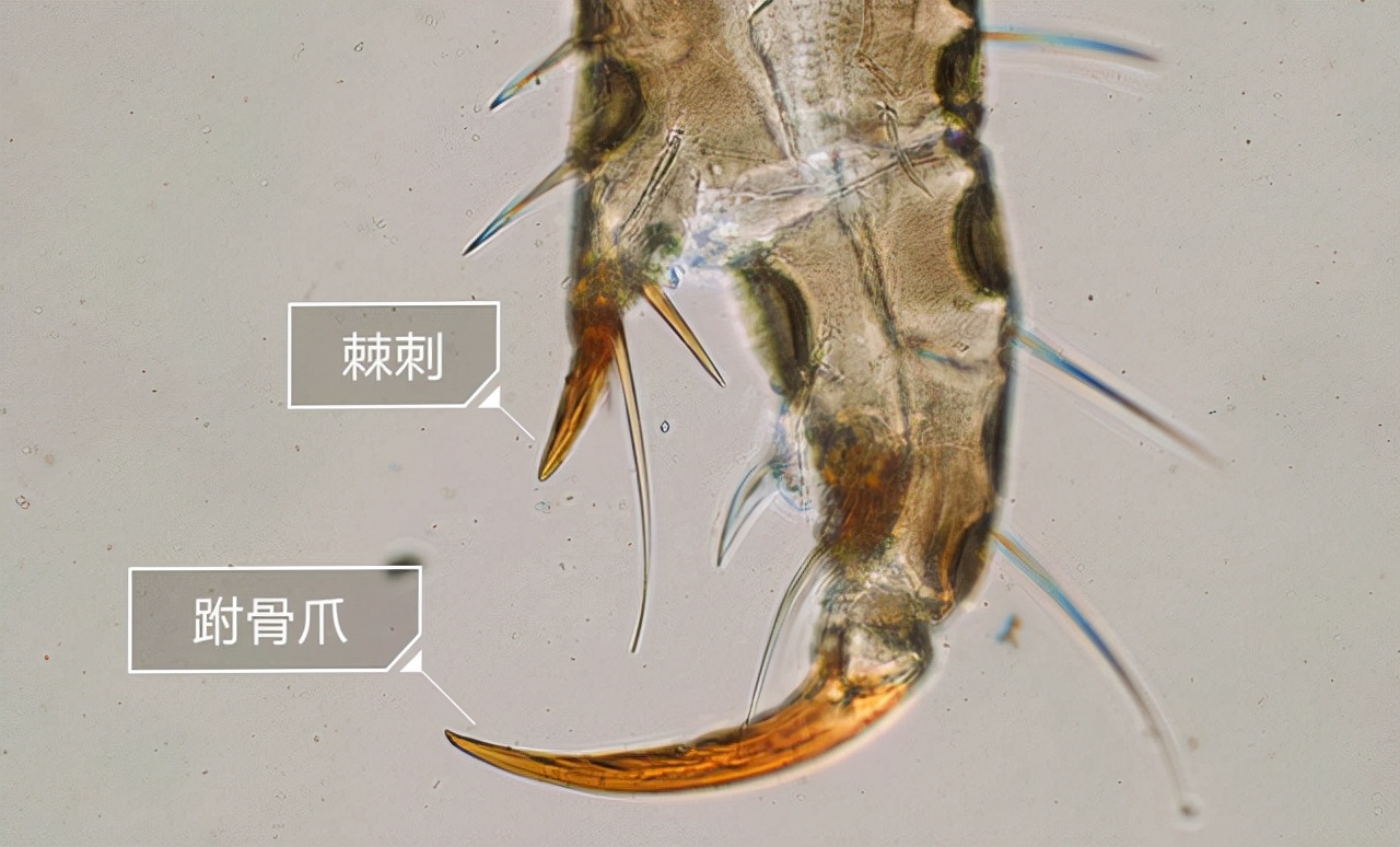 七八十年代人人头上有虱子,80年代时人们为什么会有虱子