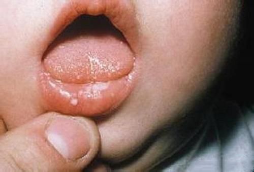 宝宝舌苔白厚消化不好怎么办,宝宝舌苔有点黄是不是胃消化不良