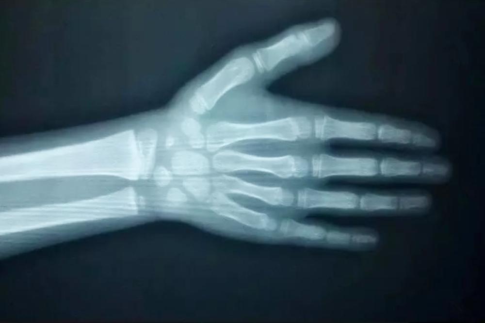 小孩怎么样加快长高,长高爸爸如何延缓骨龄