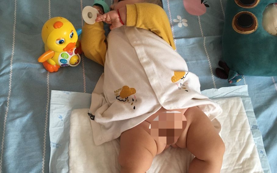 宝宝红屁屁用什么尿布好,红屁屁用尿布好还是尿不湿好