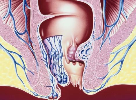 医院让人脸红的“妇科检查”，到底是如何进行的？如何避免尴尬？