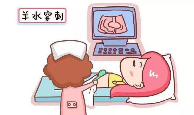 做羊水穿刺什么时间最佳,做羊水穿刺的最晚时间