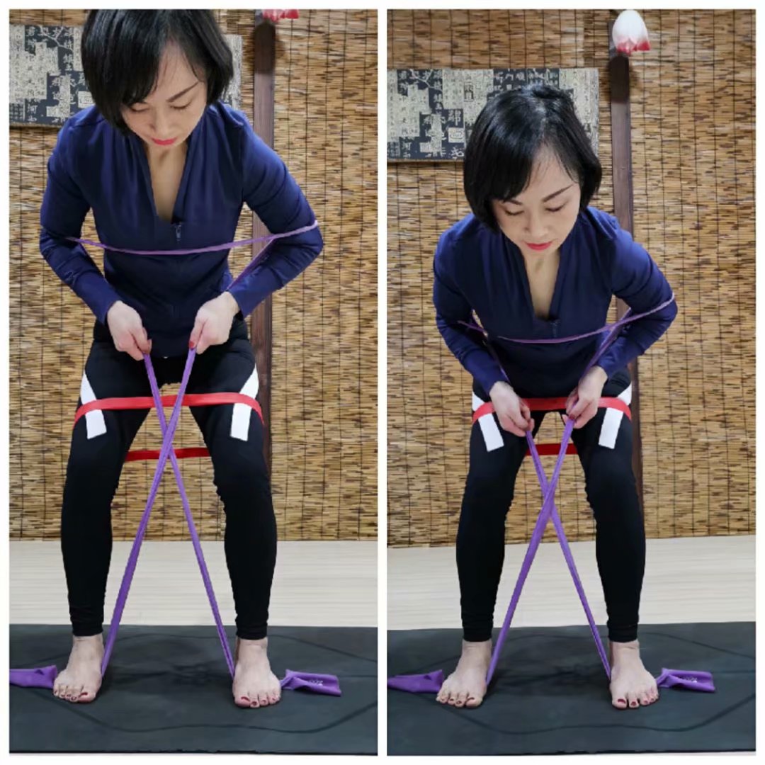 扁平足的腿型怎么改善,扁平足导致腿粗怎么办