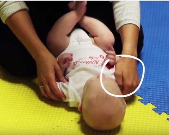 宝宝斜颈可以使用什么物理疗法,纠正宝宝斜颈最好的办法