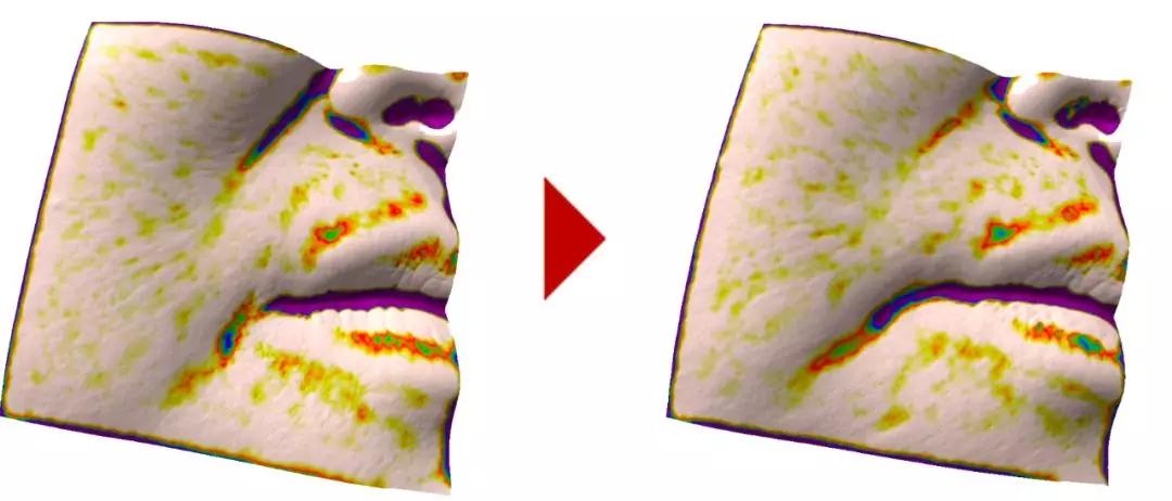 真人改造|不靠医美，一天实现“换皮”