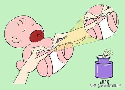 新生儿脐带一个月不掉感觉有点长,新生儿脐带你必须知道的常识