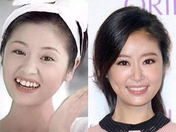 牙齿科普整牙堪比整形,整牙堪比换脸真的假的